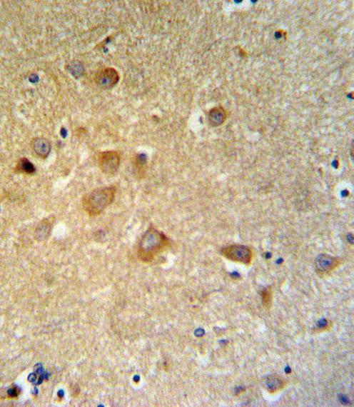 GTSE1 Antibody in Immunohistochemistry (Paraffin) (IHC (P))