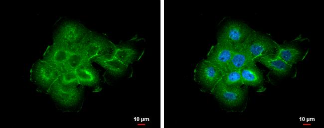 ABR Antibody in Immunocytochemistry (ICC/IF)