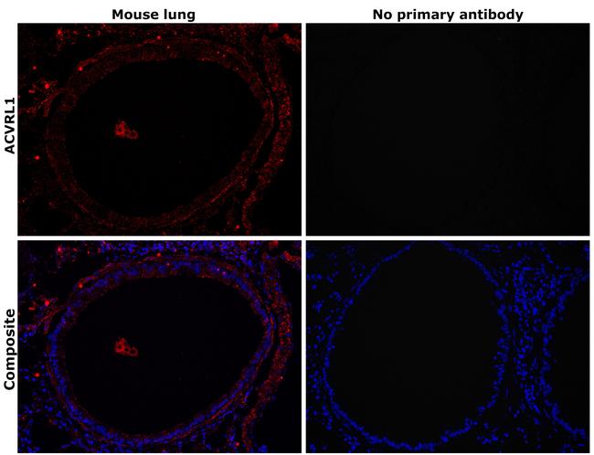 ACVRL1 Antibody in Immunohistochemistry (Paraffin) (IHC (P))