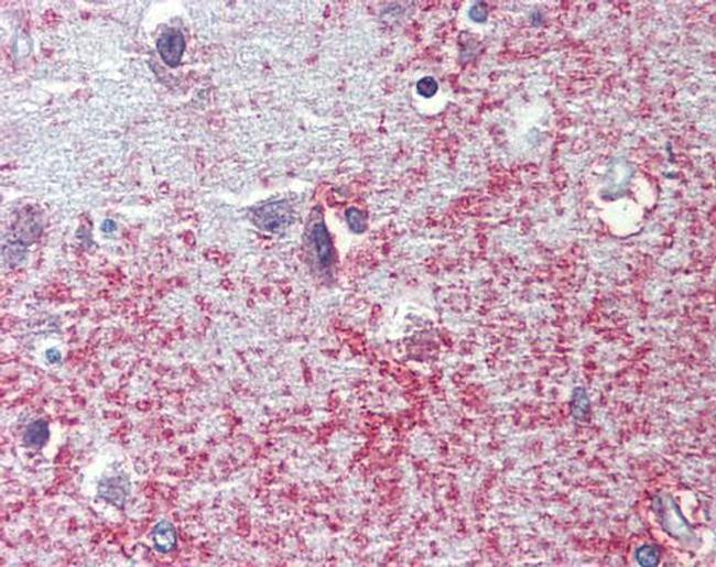 SHROOM2 Antibody in Immunohistochemistry (Paraffin) (IHC (P))