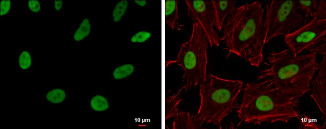 RecQ1 Antibody in Immunocytochemistry (ICC/IF)