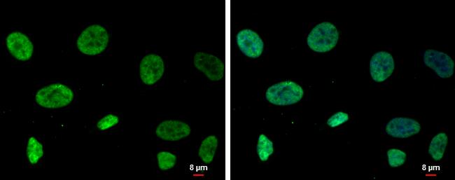 RECQ1 Antibody in Immunocytochemistry (ICC/IF)