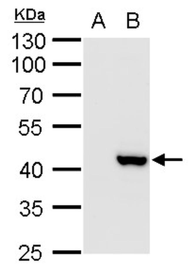 XRCC3 Antibody in Western Blot (WB)