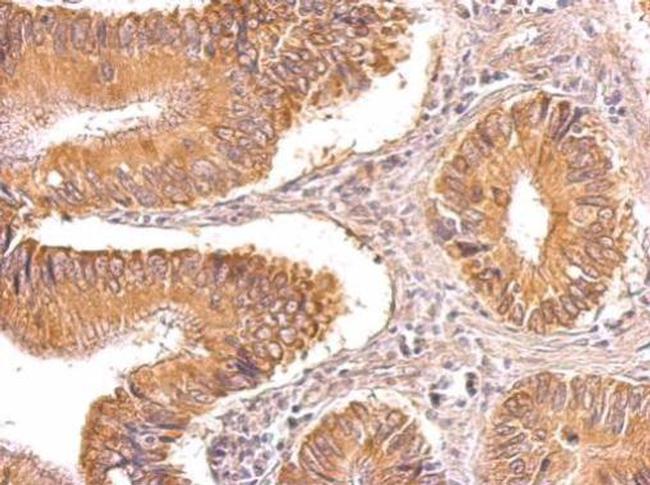 TIP30 Antibody in Immunohistochemistry (Paraffin) (IHC (P))