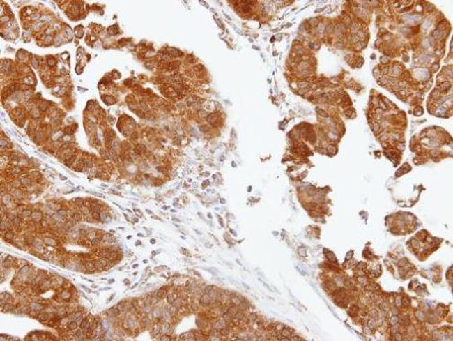 TDP1 Antibody in Immunohistochemistry (Paraffin) (IHC (P))