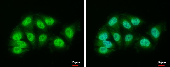 DDB1 Antibody in Immunocytochemistry (ICC/IF)