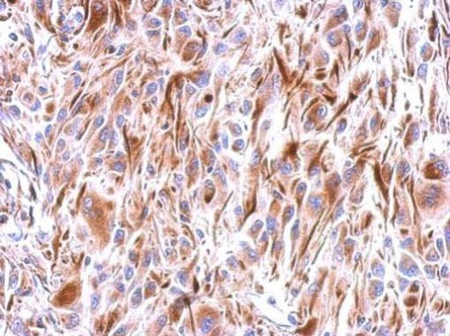 FZD9 Antibody in Immunohistochemistry (Paraffin) (IHC (P))