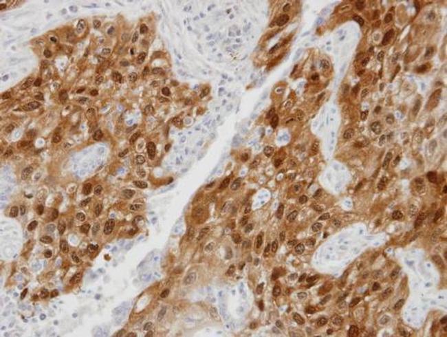 DDX5 Antibody in Immunohistochemistry (Paraffin) (IHC (P))