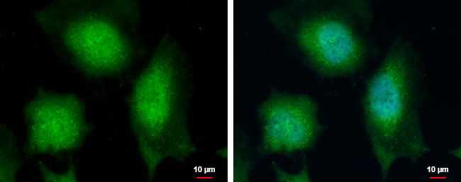 RCAN1 Antibody in Immunocytochemistry (ICC/IF)