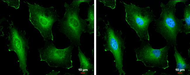 Cortactin Antibody in Immunocytochemistry (ICC/IF)