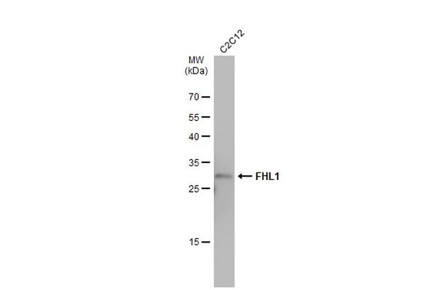 FHL1 Antibody in Western Blot (WB)