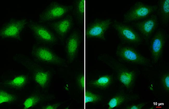 FOXO3A Antibody in Immunocytochemistry (ICC/IF)