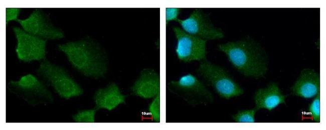 14-3-3 sigma Antibody in Immunocytochemistry (ICC/IF)