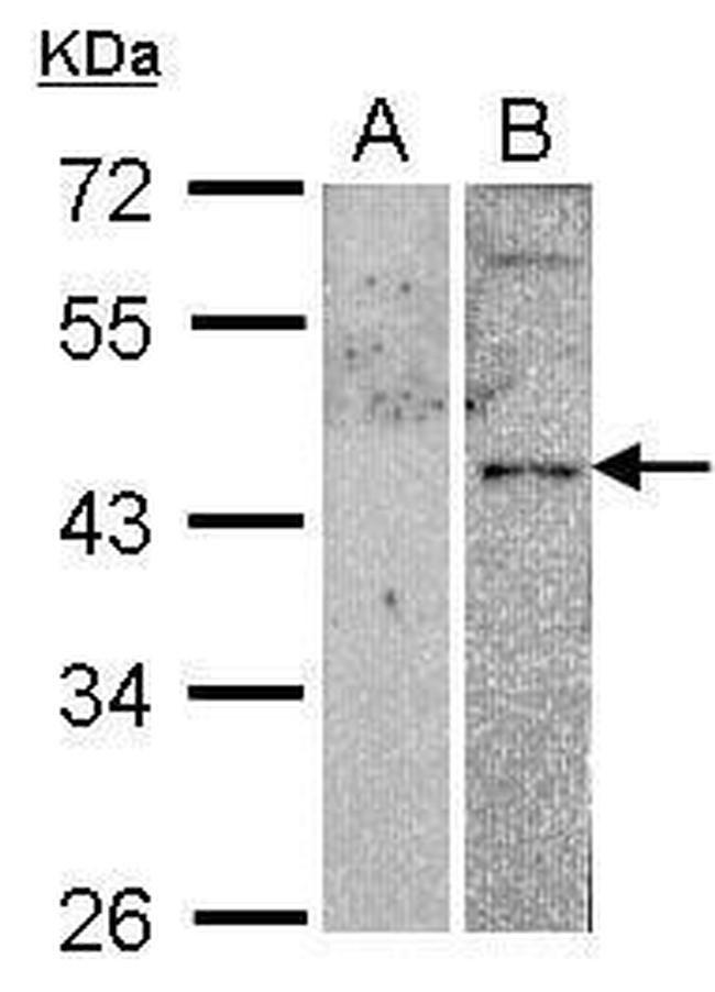 VPAC2 Antibody in Western Blot (WB)