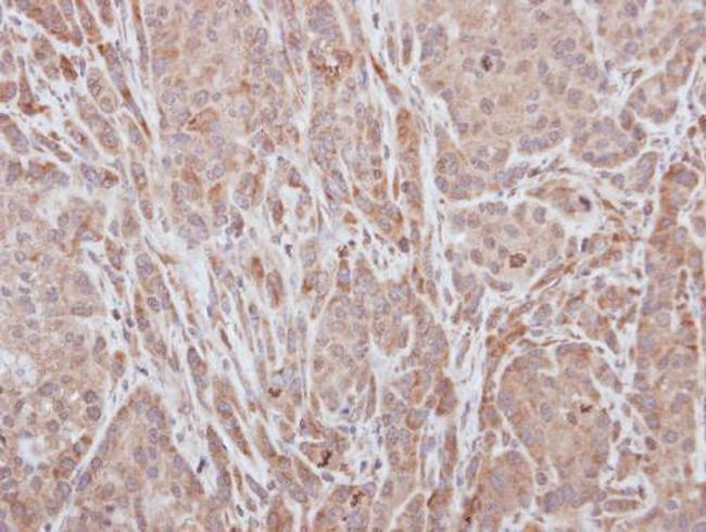 ADAMTS5 Antibody in Immunohistochemistry (Paraffin) (IHC (P))