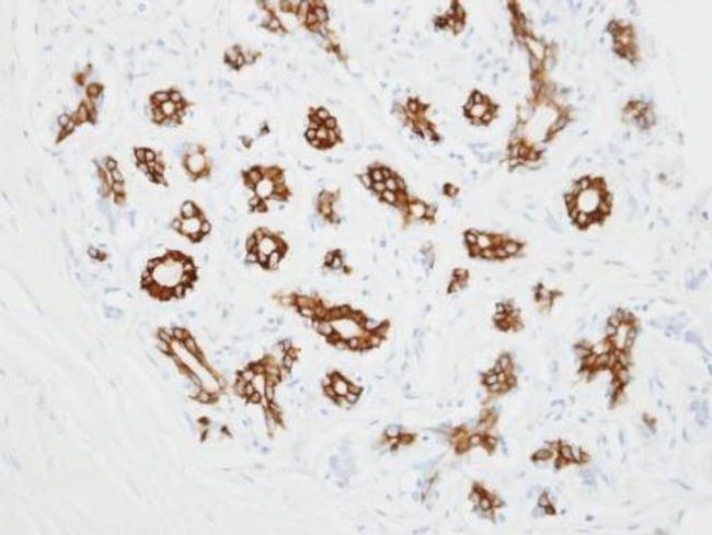 alpha-2c Adrenergic Receptor Antibody in Immunohistochemistry (Paraffin) (IHC (P))