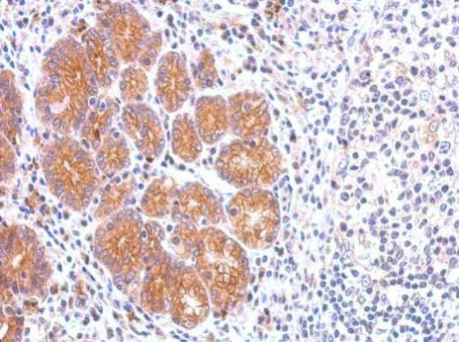 CCKBR Antibody in Immunohistochemistry (Paraffin) (IHC (P))