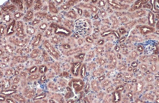 FZD10 Antibody in Immunohistochemistry (Paraffin) (IHC (P))