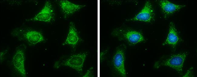 ACADM Antibody in Immunocytochemistry (ICC/IF)