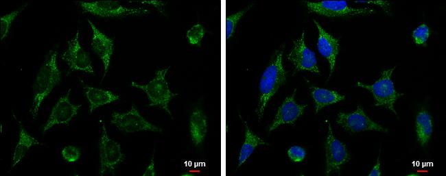 XIAP Antibody in Immunocytochemistry (ICC/IF)