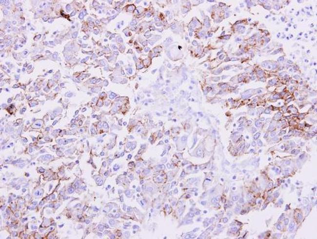 NDRG1 Antibody in Immunohistochemistry (Paraffin) (IHC (P))