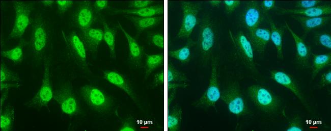 SOCS1 Antibody in Immunocytochemistry (ICC/IF)