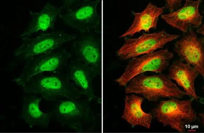 C/EBP beta Antibody in Immunocytochemistry (ICC/IF)