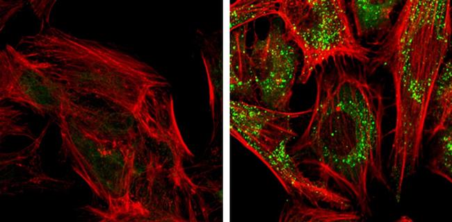 SQSTM1 Antibody in Immunocytochemistry (ICC/IF)