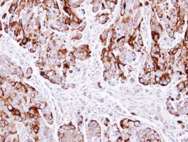 Cytokeratin 20 Antibody in Immunohistochemistry (Paraffin) (IHC (P))