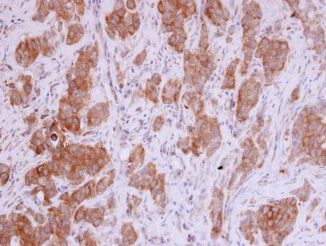 MMP12 Antibody in Immunohistochemistry (Paraffin) (IHC (P))