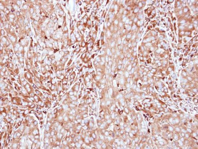 MMP3 Antibody in Immunohistochemistry (Paraffin) (IHC (P))