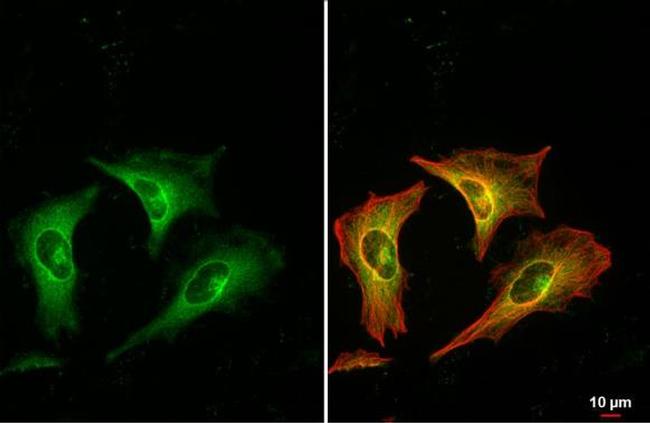 RRM1 Antibody in Immunocytochemistry (ICC/IF)