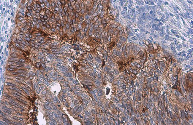 CD142 Antibody in Immunohistochemistry (Paraffin) (IHC (P))