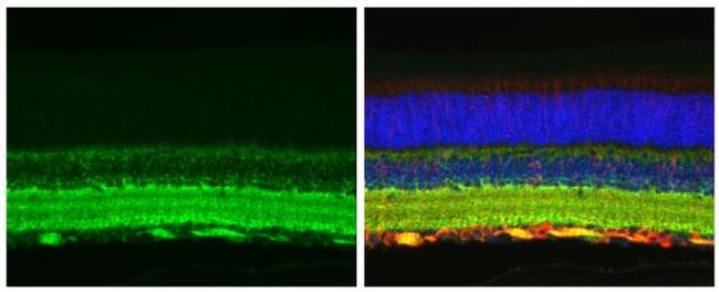 Tau Antibody in Immunohistochemistry (Paraffin) (IHC (P))