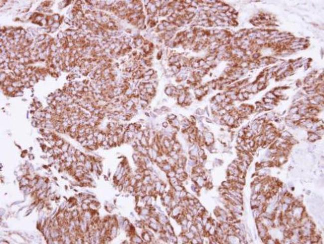 Angiopoietin 2 Antibody in Immunohistochemistry (Paraffin) (IHC (P))