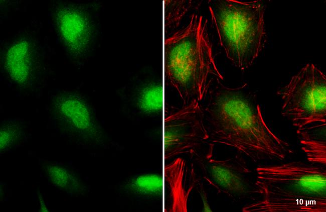 VHL Antibody in Immunocytochemistry (ICC/IF)