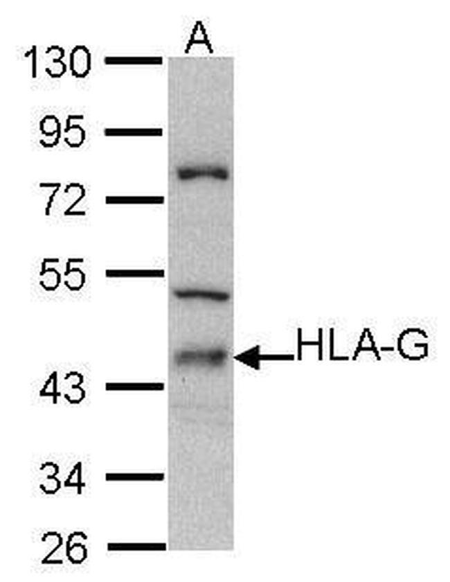 HLA-G Antibody in Western Blot (WB)