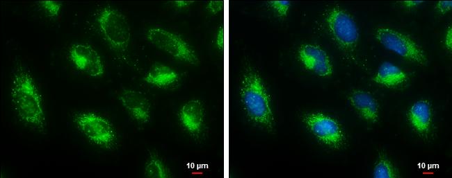 HADHA Antibody in Immunocytochemistry (ICC/IF)