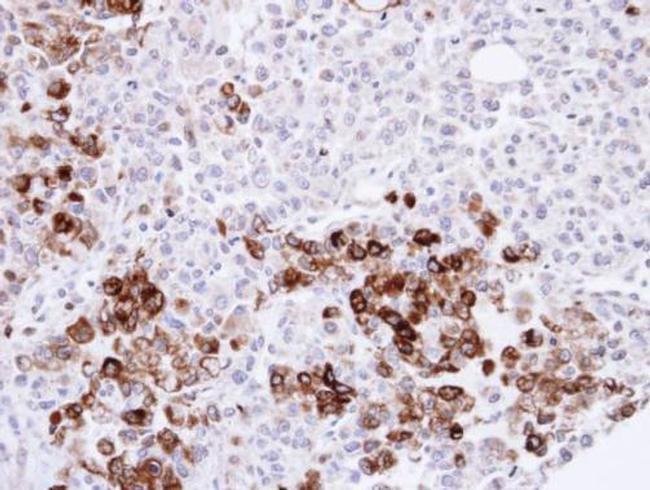 Gelsolin Antibody in Immunohistochemistry (Paraffin) (IHC (P))