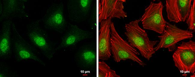 E2F1 Antibody in Immunocytochemistry (ICC/IF)