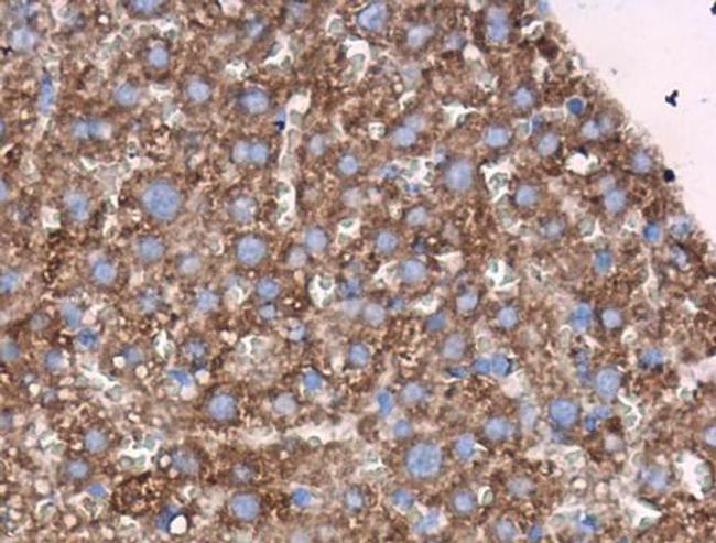 MAOA Antibody in Immunohistochemistry (Paraffin) (IHC (P))