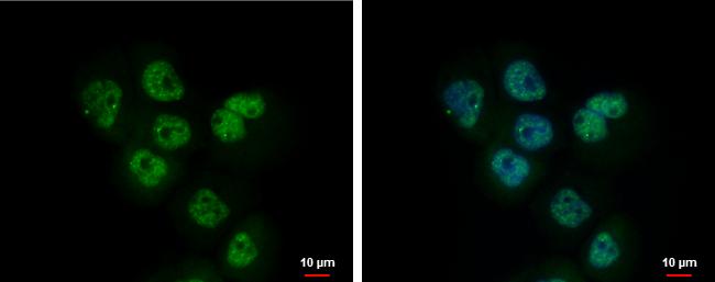 Adenosine Kinase Antibody in Immunocytochemistry (ICC/IF)