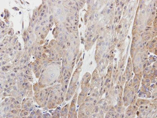 CPNE1 Antibody in Immunohistochemistry (Paraffin) (IHC (P))