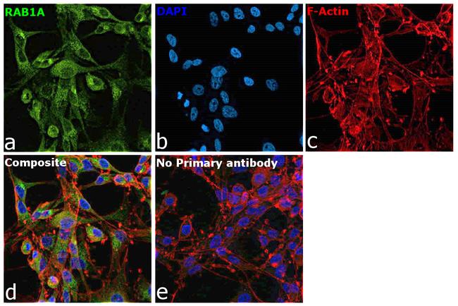 RAB1A Antibody in Immunocytochemistry (ICC/IF)