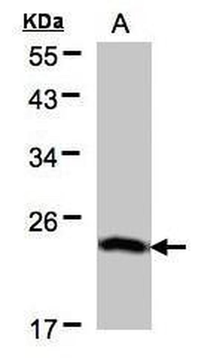 BTF3 Antibody in Western Blot (WB)