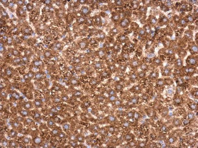 Transketolase Antibody in Immunohistochemistry (Paraffin) (IHC (P))