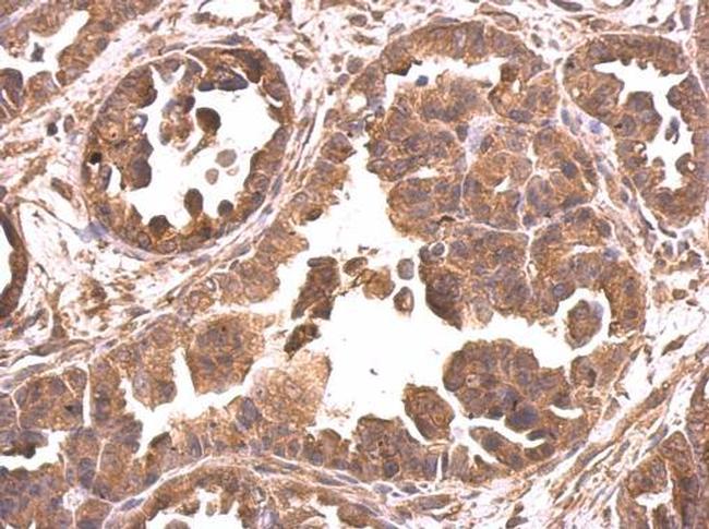 eIF4A2 Antibody in Immunohistochemistry (Paraffin) (IHC (P))