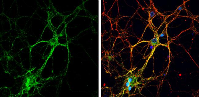 GAP43 Antibody in Immunocytochemistry (ICC/IF)