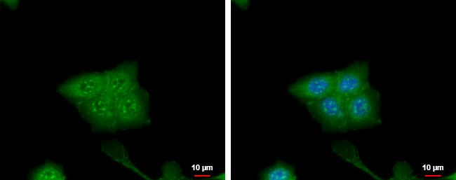 CRABP2 Antibody in Immunocytochemistry (ICC/IF)