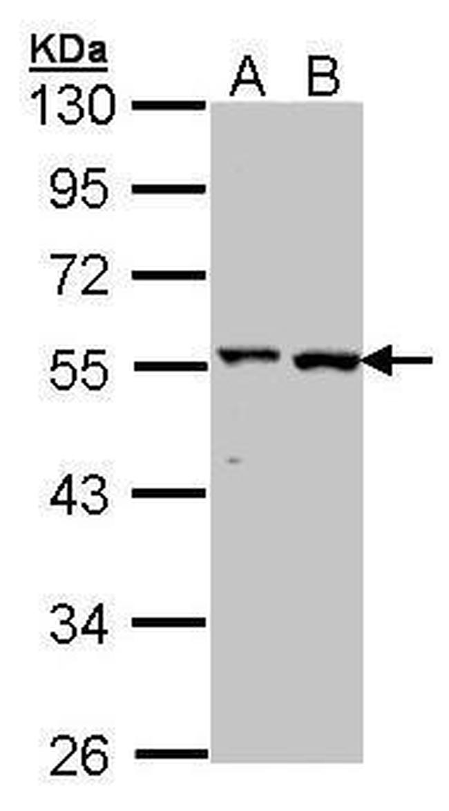 GPT Antibody in Western Blot (WB)